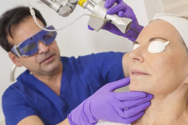 Odmłodzenie skóry za pomocą lasera